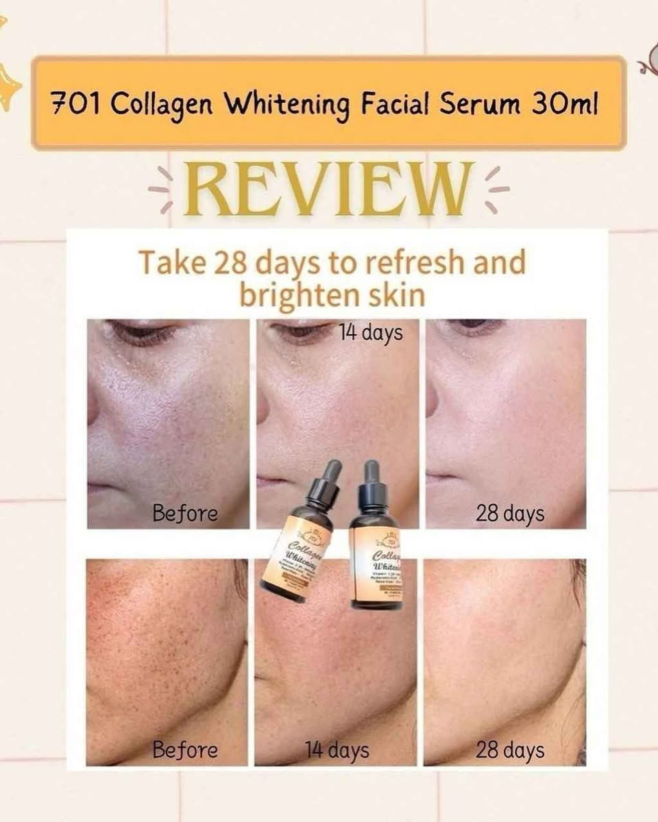 #سيروم_701 
جهزي بشرتك ووجهك للعيد 👌👌 وخلي الكل يسألك شنو مدايرة مع ❤❤❤❤

🚨🚨 سيروم  الكولاجين 😌😌
 
السيروم الخرافي 👌👌
 سيروم الكولاجين 🫶🏻🫶🏻مصل تفتيح الوجه بالكولاجين يتكون من الكولاجين وفيتامين A و E الذي يرطب ويشد البشرة ويقلل الخطوط الدقيقة على الوجه  مصل تفتيح الوجه بالكولاجين مع فيتامين سي👍  سيروم بتركيبة ناعمة غير لزجة تحتوي على تفتيح وكولاجين وفيتامين سي وغني بمكافحة الشيخوخة.  مع الاستخدام المنتظم ، يمكن أن يخفي المسام و التجاعيد الدقيقة على الوجه ويجعل بشرة الوجه تبدو مشرقة وصحية وناعمة.  طريقة الاستخدام: ضع 2-3 قطرات من السيروم على راحة اليد ثم ضعه على بشرة الوجه التي تم تنظيفها حتى خط العنق بالتساوي.  استخدمي السيروم قبل استخدام الكريمات أو مستحضرات التجميل الأخرى في الصباح والمساء بانتظام

سيروم #701 بغداد, العراق


**إذا كنت صاحب هذا الإعلان وتريد حذفه لأي سبب، رجاءا أرسل رسالة إلى الدعم الفني**