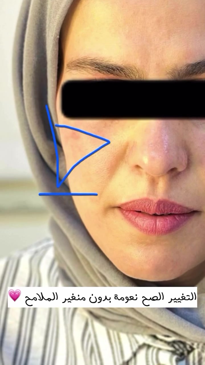 تغيير شامل باستخدام الفلر !💗

للحجز والاستفسار دايركت مسج او على الارقام التالية 
***********
***********
العنوان: الديوانية -الحمزة الشرقي -شارع الاطباء #فلر #fyp
