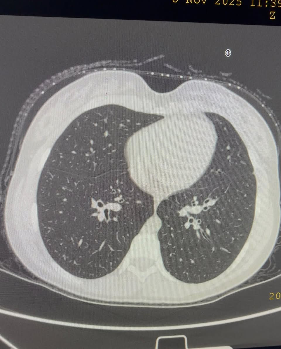 تتواجد غدا الأربعاء ان شاء الله الدكتورة نهى فارس عطااللة الجبوري اخصائية الاشعة التشخيصية دكتوراه بورد عربي زميلة المجلس العربي للاختصاصات الصحية 
سونار ودوبلر ومفراس ورنين 
سونار ودوبلر البطن 
سونار ودوبلر اوردة وشرايين العنق 
سونار ودوبلر اوردة وشرايين الاطراف العليا 
سونار ودوبلر اوردة وشرايين الاطراف السفلى لكشف التخثر والدوالي 
سونار ودوبلر العضلات والمفاصل 
سونار الثدي وسونار الغدد 
سونار الدماغ للأطفال وسونار الخلع الولادي 
سونار الجلد وسونار العين 
يوجد في العيادة اشعة ملونة لفتح الانابيب 
عنوان العيادة القيارة شارع البيكمات مجمع الكوثر الطبي مقابيل روتانا مول 
اوقات دوام العيادة من الساعة الواحدة ضهرا إلى الساعة السابعة مساءا 
يوم السبت ويوم الأربعاء من كل اسبوع 
للحجز والاستفسار الاتصال على رقم العيادة ***********
