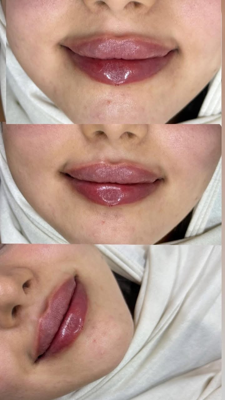 اليوم مسابقتنا غييير ❤️‍🔥❤️
صاحبة الصورة الي تحصل اكثر عدد من اللايكات 
تفوز ويانا بجلسة نضارة الريفتا مجانية❤️
شوفو الصور وسوو لايك
وسوو تاك لصديقاتكم يفوزوكم😍
كل فترة اختار كم صورة نسوي عليهم مسابقة حتى يفوزون مراجعاتنا الدائمات❤️❤️❤️😍


**إذا كنت صاحب هذا الإعلان وتريد حذفه لأي سبب، رجاءا أرسل رسالة إلى الدعم الفني**