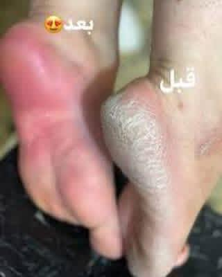 تخفيظات العيد يمناغير 🌺🌺


**إذا كنت صاحب هذا الإعلان وتريد حذفه لأي سبب، رجاءا أرسل رسالة إلى الدعم الفني**