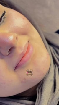 بدون تعديل • بدون فلتر • صور وفيديو