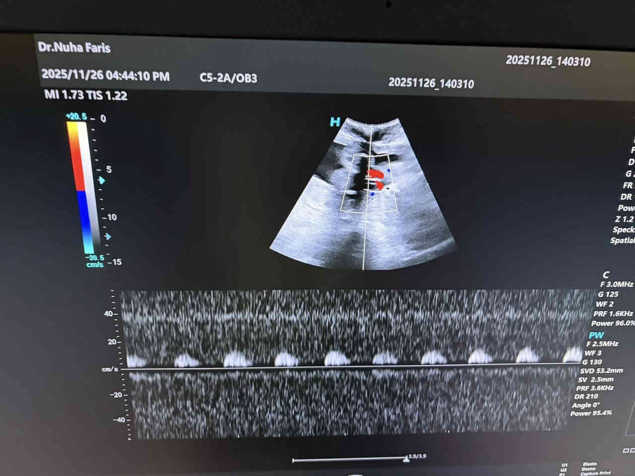 تتواجد غدا السبت ان شاء الله الدكتورة نهى فارس عطااللة الجبوري اخصائية الاشعة التشخيصية دكتوراه بورد عربي زميلة المجلس العربي للاختصاصات الصحية 
سونار ودوبلر ومفراس ورنين 
سونار ودوبلر البطن 
سونار ودوبلر اوردة وشرايين الاطراف العليا 
سونار ودوبلر اوردة وشرايين الاطراف السفلى 
سونار الثدي وسونار الغدد 
سونار ودوبلر العضلات والمفاصل 
سونار الدماغ للأطفال وسونار الخلع الولادي 
سونار الجلد وسونار العين 
يوجد في العيادة اشعة ملونة لفتح الانابيب 
عنوان العيادة القيارة شارع البيكمات مجمع الكوثر الطبي مقابيل روتانا مول 
اوقات دوام العيادة من الساعة الواحدة ضهرا إلى الساعة السابعة مساءا 
يوم السبت ويوم الأربعاء من كل اسبوع 
للحجز والاستفسار الاتصال على رقم العيادة ***********
