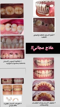 خدمات مجانية • تنظيف أسنان • جامعة المشرق