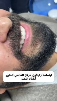 زاركون ايماكس • مركز العالمي الطبي • قضاء النصر