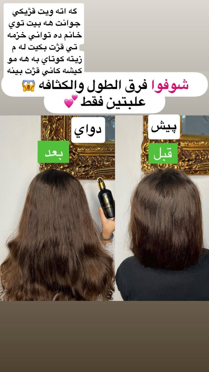 كي حه زه كات قژيكي جوانو پري هه بيت  باشترين زه يت


**إذا كنت صاحب هذا الإعلان وتريد حذفه لأي سبب، رجاءا أرسل رسالة إلى الدعم الفني**