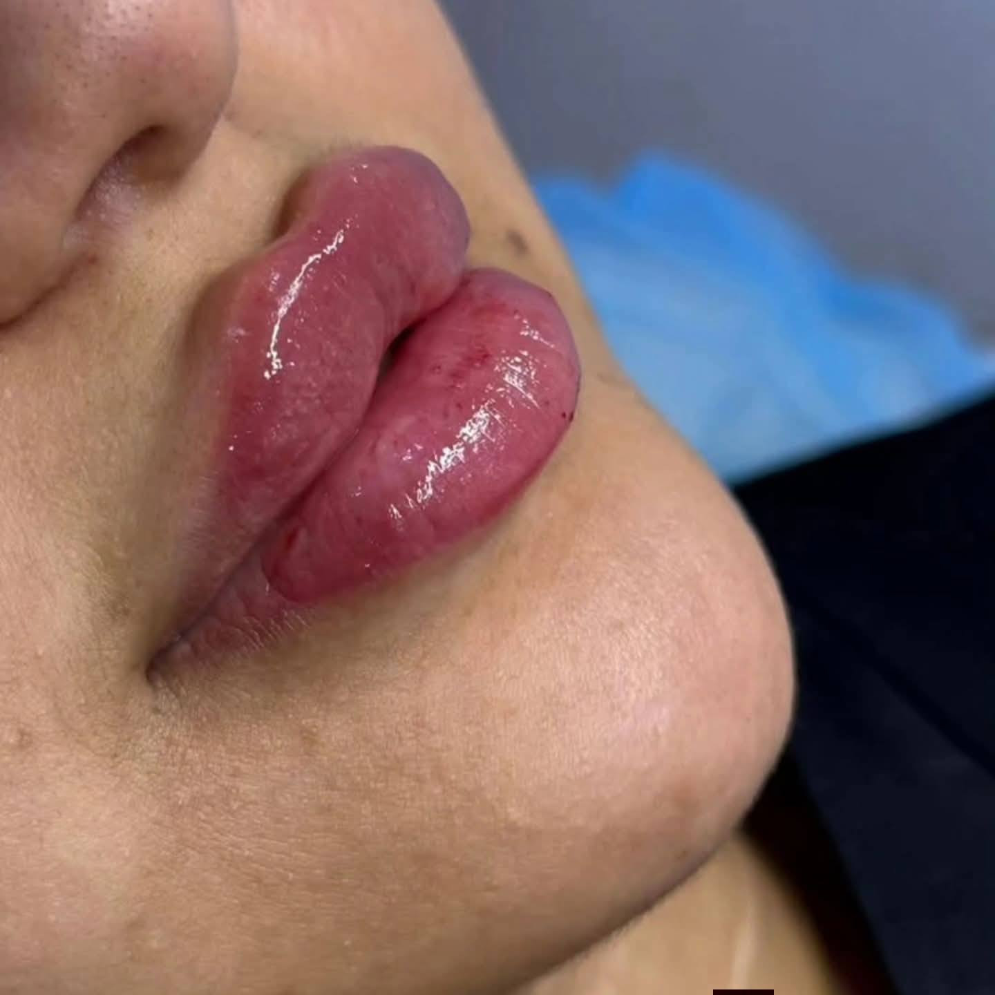 عروض العيد يم صالون الروان
فلر شفه بيد دكتوره صابرين مبدعه
خطم 80%عرض العيد على فلر الشفة مختلفه يمنه😍🔥🔥💋❤️⚘️✅️
احجزي الآن قبل انتهاء العرض 
للحجز والأستفسار 💋***********
