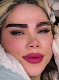 زراعه الحاجب بتقنيه الشريحه او الشعيرات🌹 ✨✨مع الوطني الاماراتي  احجز ا...