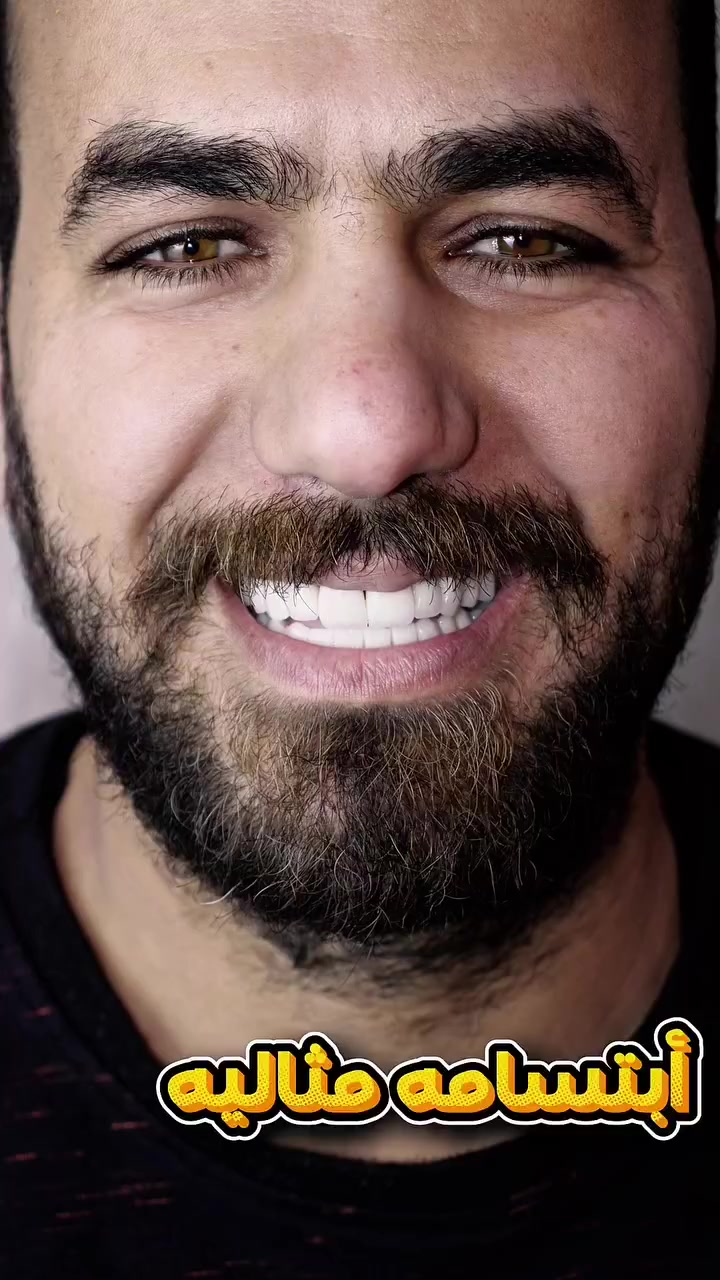 ✨ إعادة تأهيل كاملة للفم مع ابتسامة جديدة ✨
تم إجراء زراعة أسنان وإعادة تصميم الابتسامة للوصول إلى نتيجة ووظيفية عالية 💎
تم العمل بدقة على تعويض الأسنان المفقودة وتحسين الشكل الجمالي للابتسامة، مع مراعاة التوازن بين الوظيفة والمظهر 👌
🤝 العمل كان مشترك مع الدكتورة حوراء الشمري
📍 في عيادة هايجنك
النتيجة: ابتسامة واثقة… وحياة أفضل ✨ 
الدكتور علي الغريفي 
ماجستير جراحة وزراعة الاسنان 
***********
