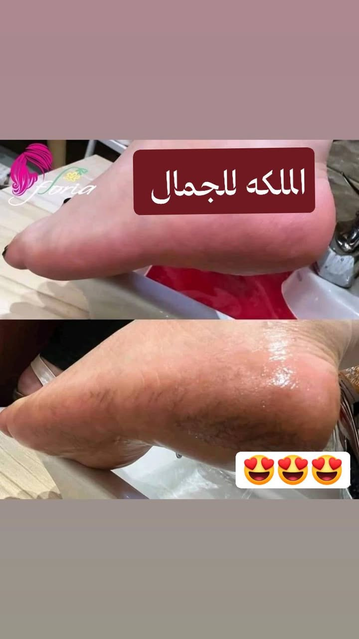 رجعت وياكم بنات بالشغل اسف مجاي انشر ونكطعت بس ظروف


**إذا كنت صاحب هذا الإعلان وتريد حذفه لأي سبب، رجاءا أرسل رسالة إلى الدعم الفني**
