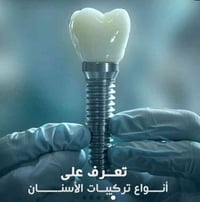 مركز الزهراء الطبي • زراعة الاسنان • تجميل الوجه