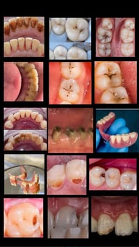 يتوفر لدينا ، قلع تنظيف اسنان، حشوات تجميلية ، تركيب بانواعه ..  علما ...