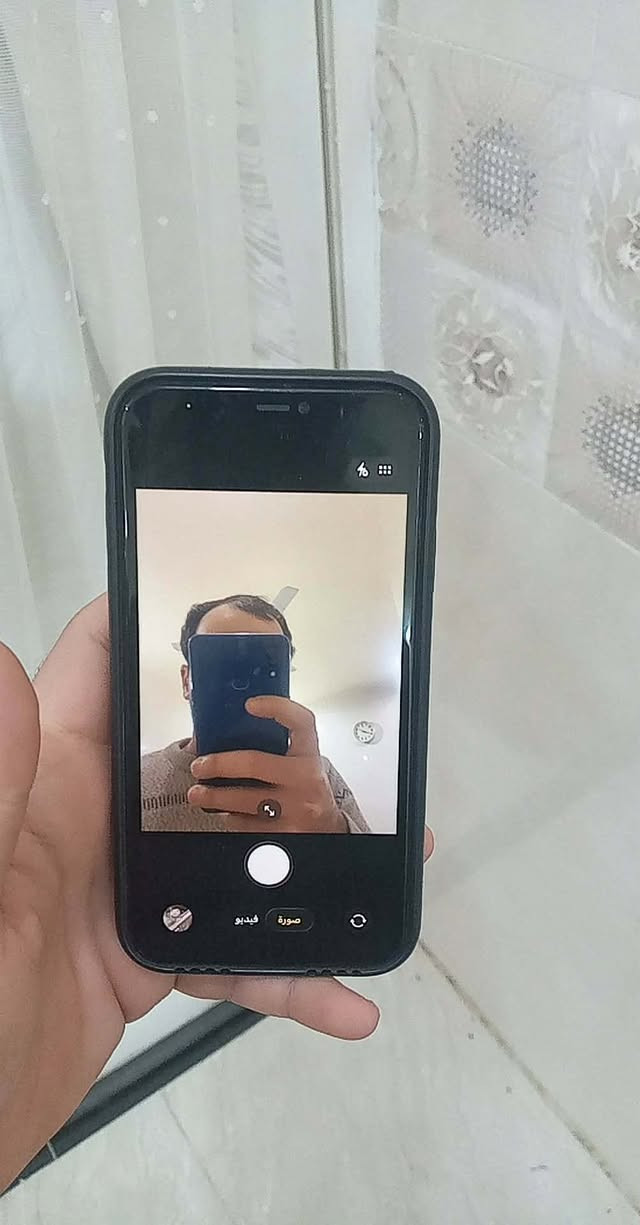 سلام عليكم
١١عادي. 

مبدل شاشه بس 

٣ خيارات 

بطاريه اصليه ٨٠ 

ذاكره ٦٤ 

للبيع أو مراوس ب ١٣ 

سعر ٢٧٥


**إذا كنت صاحب هذا الإعلان وتريد حذفه لأي سبب، رجاءا أرسل رسالة إلى الدعم الفني**