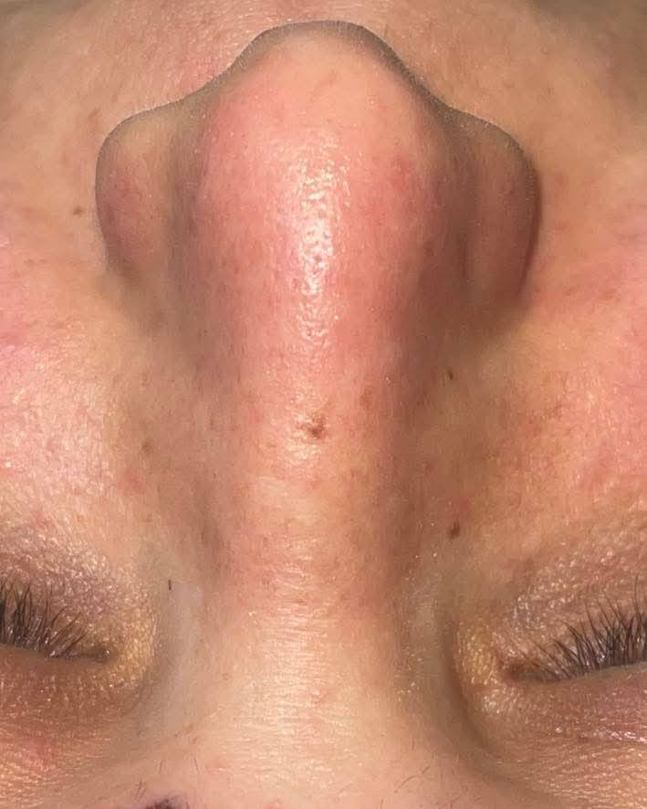 ⸻

✨ خلي بشرتچ تبدي صفحة جديدة… ✨
مو بس تنظيف، جلسة تعيد لبشرتچ هدوءها ولمعتها الطبيعية.

💠 نفتح المسام ونخلّيها تتنفس
💠 نزيل التراكمات اللي تعبت بشرتك
💠 لمسة ترطيب تخلي وجهك يلمع بدون فلاتر
💠 إحساس خفّة وراحة يبان من أول نظرة

جلسة صغيرة… فرق كبير.
📩 للحجز: راسلينا وخلي نضارة وجهچ ترجع تحچي عنچ بنفسها 
📍 العنوان: المدحتية / الجمعية مقابل أسواق حاتم للتسوق المنزلي
📞 الحجز: ***********
