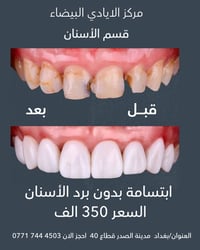 ✨ مركز الأيادي البيضاء – قسم الأسنان ✨ نقدم لكم أفضل خدمات الأسنان وبخ...