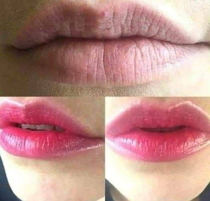 🌸امبولات توريد الشفاه والخدود
🌸Glow BB Lip 
وداعا لمراكز التجميل توريد الشفه بطريقة طبيعية غير جراحية أو مؤلمة
تخلصي من شفاء  بيضاء وحافه و ذات المنظر غيرالمرغوب به💔 
احدث تقنية و غير مؤلمة في تلوين الشفاه والحصول على احمر شفاه شبه دائمي يدوم ٦ اشهر تقريباً 

...تخلصي من المكياج واستقبليلي الصباح بشفاه ورديه 
اكيد كلكم تعرفون هاي الماده شنو تأثيرها ع البشره  من ناحيه التوريد تجنن وطبعا تسوي الخد ابيض على وردي والشفه وردية

السيت يحتوي على ١٢ امبولة
وكل امبولة تكفيج استعمال مرتين الى ٣ مرات 🌸

🌼❤طريقة الاستعمال : ❤🌼
توضع الماده على جميع انحاء البشره تمرر الدرمارولر على جميع انحاء البشره ، يتم تمرير الدرمارولر على المكان الواحد من ٥ الى ٧ مرات او تمرر مرة واحده للديرمابن بعد الانتهاء ، يترك الخد او الشفه لمدة ربع ساعه وبعدها تمسح الماده  المتبقيه على البشره و غسل الوجه بالماء النقي 
يتم تكرار العمليه كل اسبوع مرة واحدة للبشره الحساسه
و مرتان بالاسبوع للبشره الاعتياديه
صنع في كوريا
احذروا التقليد 🚫
🚘 يوجد خدمة توصيل لجميع محافظات العراق 🚘


**إذا كنت صاحب هذا الإعلان وتريد حذفه لأي سبب، رجاءا أرسل رسالة إلى الدعم الفني**