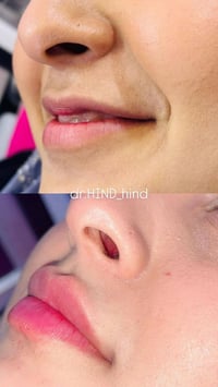 الفلر • نتايج فورية • المحمودية