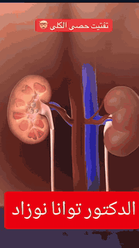 #الدكتور توانا نوزاد عمر  👨‍⚕️يتواجد يوم الاربعاء 
#طبيب  في اختصاص جراحة الكلى والمسالك البولية

#للحجز ☎️***********☎️# 

☎️***********☎️☎️

♦️جراحه الكلى والمسالك البولية

♦️علاج التهابات المجاري البولية 

♦️علاج  حصاه الكلى والحالب والمثانة

♦️علاج الضعف الجنسي والعقم عند الرجال

♦️علاج البروستات 

#يتواجد في مجمع الكندي الطبي 

#الحويجة شارع الاطباء
