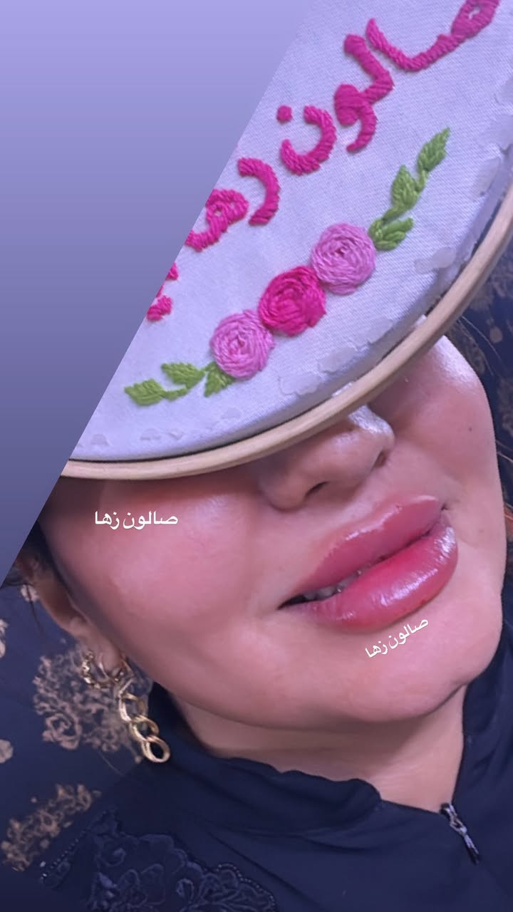 عرض بكج أميرات صالون زها 

جلسه نضاره مع فلر اودري تغير شامل 12 سيسي ب 200 الف فقط 
جلسه نضاره مع فلر اودري تغير شامل 6 سيسي ب 100 الف فقط 
جلسه نضاره مع فلر اودري تغير شامل 3 سيسي ب 50 الف فقط 

جلسه نضاره مع فلر ابتك تغير شامل 10 سيسي ب 400 
جلسه نضاره مع فلر اراستي تغير شامل 10 سيسي ب 600
جلسه نضاره مع فلر سويسري تغير شامل 10 سيسي ب 800 

فلر شفه اودري ب 25 
فلر شفه ابتك ب 50 
فلر شفه اراستي ب 75 
فلر شفه سويسري ب 100 
فلر شفه الايطالي ب 150 

فلر شفه مع وجنات مع جلسه نضاره ب 75 الف فقط

جلسه نضاره مع تنظيف البشره ب 25 
جلسه نضاره مع تنظيف البشره ب 50 
جلسه نضاره مع تنظيف البشره ب 75 
جلسه نضاره مع تنظيف البشره مع مكس كامل ب 100 
جلسه نضاره مع تنظيف البشره مع مكس كامل ب 125 
جلسه نضاره مع تنظيف البشره مع مكس كامل ب 150 
تفاصيل الجلسات نشرحه الكم بعد المعاينه وننصحكم بالشي التختاروا واليفيدكم

للحجز والاستفسار واتساب *********** ادمونه زهراء
