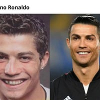 ⚽️  ابتسامة الأساطير  🦷  بين سحر "الدون" ودقة عيادة لوركا  ​في عالم كر...