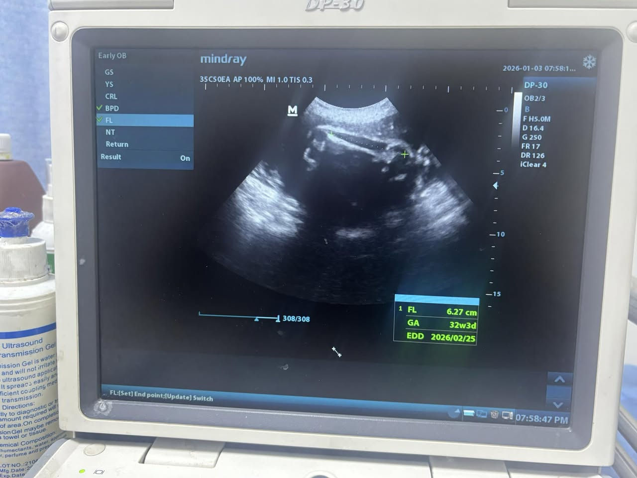 من حالات العياده
الي متابعه من الألف للياء وتطمن على سلامتها وسلامه النونو ربي يكونون بالسلامه ان شالله هي والنونو♥️🙏
ولد على ثنين بنوتات

د.انجي سعيد متي
بغداد/ابو دشير الشارع العام مجاور غذائيه ابو جواد
📍مجمع الحياه الطبي
كل ايام السبت والثنين واربعاء 
📩رقم الحجز ***********⁩
