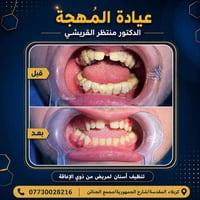 تنظيف الأسنان • ذوي الإعاقة • كربلاء المقدسة