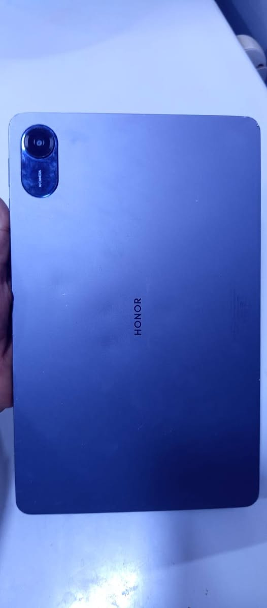 للبيع تاب هونر باد X9 (Honor Pad X9) مستعمل - كامل ملحقاته الأصلية
** تفاصيل الجهاز:**

الشاشة: نظيفة وسليمة 100% وبدون أي مشاكل.

الأداء والبطارية: بحالة ممتازة جداً (استخدام نظيف للبطارية).

الملحقات: الكارتونة الأصلية + الشاحن البلادي (الواير والفيشة الأصلية).

** الملاحظات (للأمانة وبدون غش):**

توجد خدوش بسيطة في الظهر نتيجة الاستخدام.

يوجد ثلم صغير جداً في حافة الألمنيوم (بعيد عن الشاشة تماماً ولا يؤثر على الجهاز).

الكفر مكسور (يعني تحتاج تشتري له كفر جديد).

** السعر:**  155الف (وبي مجال طيب).
** المكان:** [حي الأمامين]
** للتواصل:** [***********]

