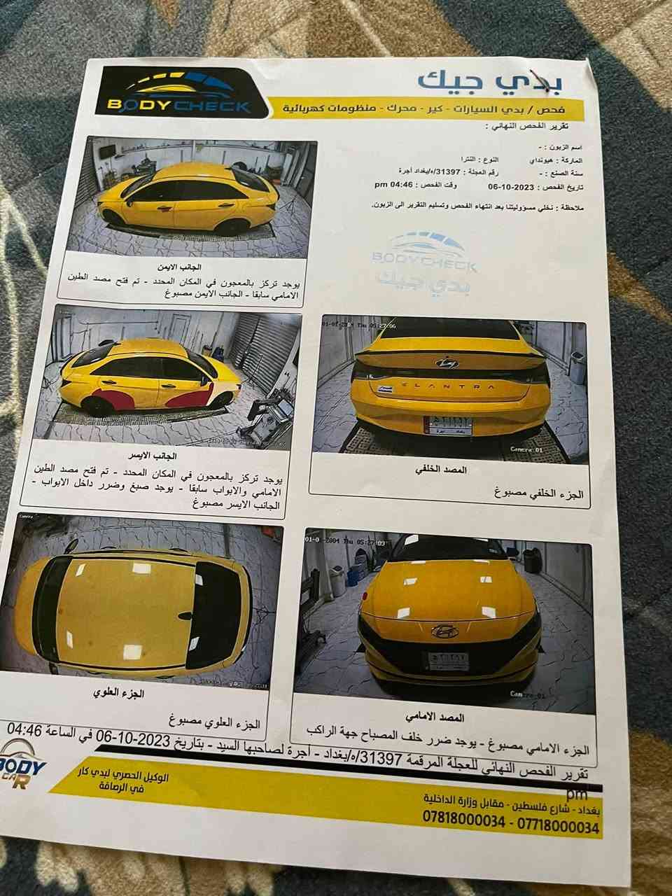 النتر 2021كير اي تي منضومه غاز  تخم تاير حداديه كير محرك كفاله تحديد مسار بصمه تحويل مباشر مصفر هيه مرور سايد برك بصمه 137 بيه مجال مكان سيارة بابل ***********
