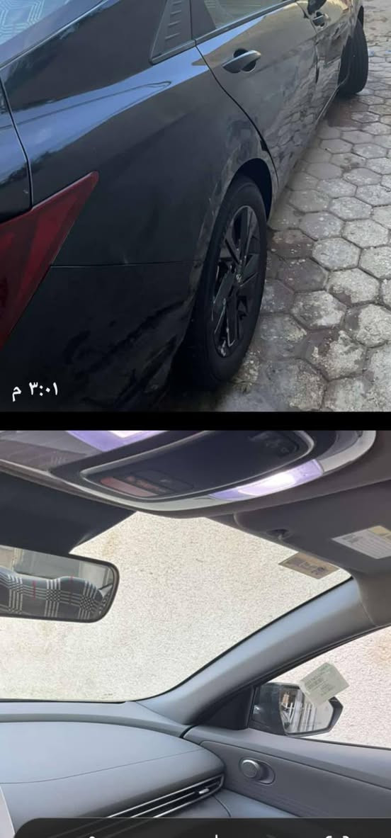 السلام عليكم الإنتر 2023 لبيع سياره مرقمه وجاهزة وارداد أمريكي سياره ماشيه 56 ألف سرقه مابيه حادث
السعر 150 وبيهه مجال موعوقين ***********
