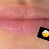 عروض عيد الأضحى • عيادة حنين • أسنان وتجميل