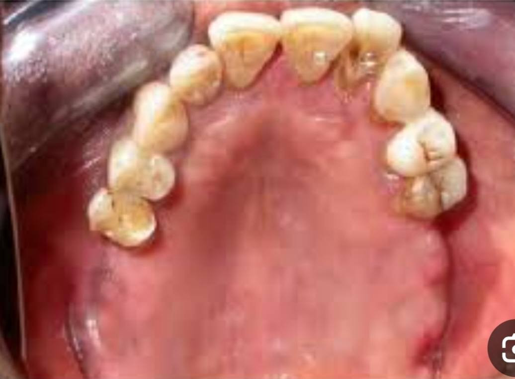 السلام عليكم
الي فاقد اسنان تشبه الحالات البصور يراسلني واتساب
***********
العنوان الكرادة شارع ٥٢ جامعه اوروك
