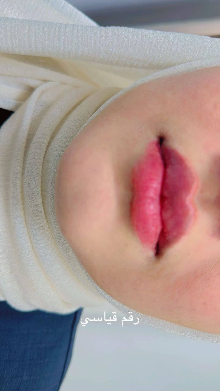 عياده الدكتورة شذى عبد الأمير   مسويتلكم عروض💖 عل فيلر ✨ بمناسبة الفلنتاين ✨
عنوان الحسينية _ عيادات الوادي النوذجية _ مجاور مطعم ابن مدلول الطابق الأرضي 

للحجز والاستفسار ***********
