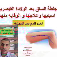 ❤جلطة الساق بعد الولادة القيصرية!!! 👩‍⚕️ صيدلية نور عبدالله الزلزلي 🔹️...