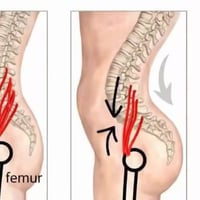عضله وحده تسوي ألم #فضيع في الظهر   ✨🌿  #عيادة_العامريه_للعلاج_الطبيعي...