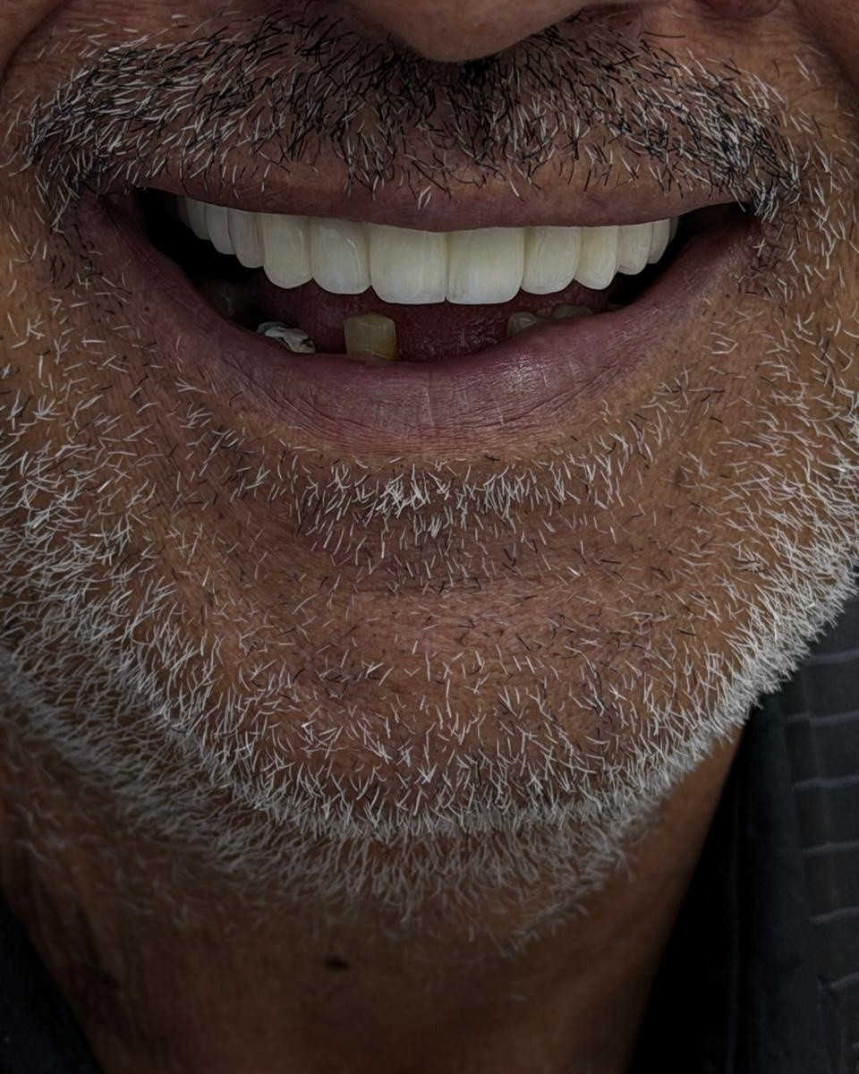 نحن لا نغير هويتك، بل نكشف عن النسخة الأجمل منك؛ في مركز الوارث، نبتكر لك إشراقةً خاصة تتحدث عن ثقتك قبل أن تنطق بكلمة 
من اعمال طبيبنا المتميز🫡
د محمد السخي
📍 متواجدين يومياً طول أيام الأسبوع:
⏰ من الـ9 الصبح للـ12 الظهر
⏰ ومن الـ2:30 العصر للـ9:30 بالليل

📞 للتواصل ويانه:
✅ العيادات البشرية: ‎***********
✅ عيادات التجميل: ‎***********
✅ عيادات الأسنان: ‎***********

📍 العنوان: الناصرية – شارع بغداد، مجاور مدرسة الجواهري الأهلية
