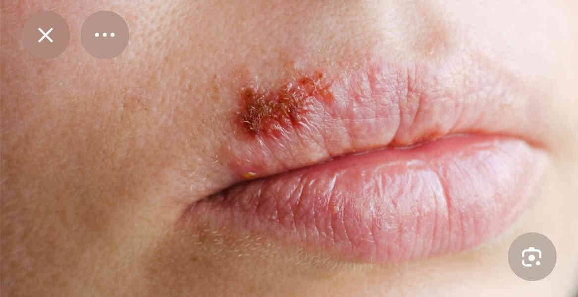 📍مجانا لفتره محدوده 
 سلام عليكم , الي عنده مثل هاي الحالات يتواصل ويايه نعالجها اله  

العنوان / كربلاء الجمعيه خلف مول الحارث مجاور سيطرة الاحياء او كراج المخيم 
للحجز التواصل على واتساب  
* ***********
