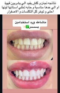 هاشاك • كوزمتك