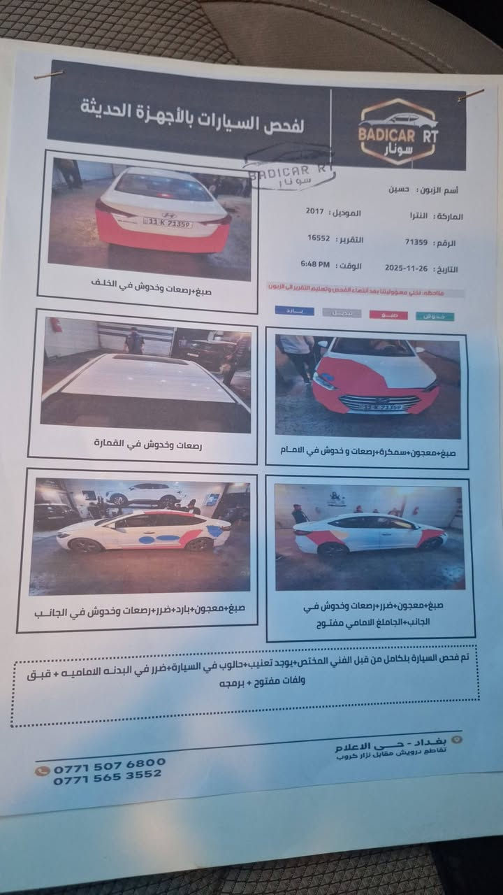 السلام عليكم النتر للبيع موديل ٢٠١٧ خليجي محرك ٢٠٠٠ فول عدا البصمه العنوان الشعله تليفون ***********
السعر ١٢٨ كلشي واضح يمك واهلا وسهلا
