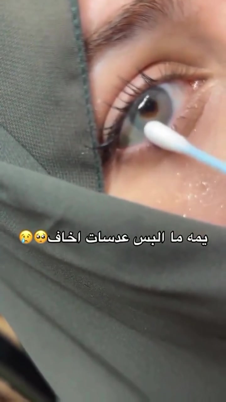اشكم عدسه لبست  احد يعرف؟! 🫠🤍

✨ عدسات مكبّرة للعين من اسنس✨

👁️ جمال يلفت + تكبير يبرز العين
🎨 متوفرة بـ 5 ألوان فخمة تناسب كل الأذواق
💎 تعطي عين أوسع ولمعة طبيعية
🌸 ناعمة ومريحة للبس اليومي
💧 مع سائل وحافظة – ست كامل
👑 اختيار الأميرات لكل مناسبة

دلّعي عيونچ وغيّري لوكچ بلحظة 💋

#اكسبلور #اكسبلور_فولو #فيروزة_ستايلك #لايكاتكم_تسعدني #explore


**إذا كنت صاحب هذا الإعلان وتريد حذفه لأي سبب، رجاءا أرسل رسالة إلى الدعم الفني**