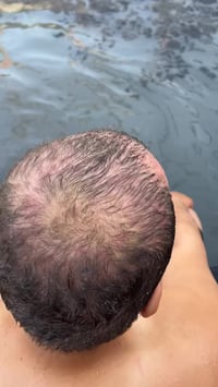 نوفر خدمة التوصيل إلى جميع المحافظات. طين حمام العليل علاج طبيعي فعال ...