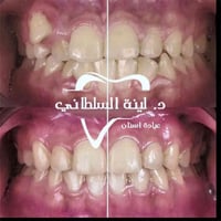 عيادة لينة السلطاني • تقويم شفاف • تقسيط بدون كفيل