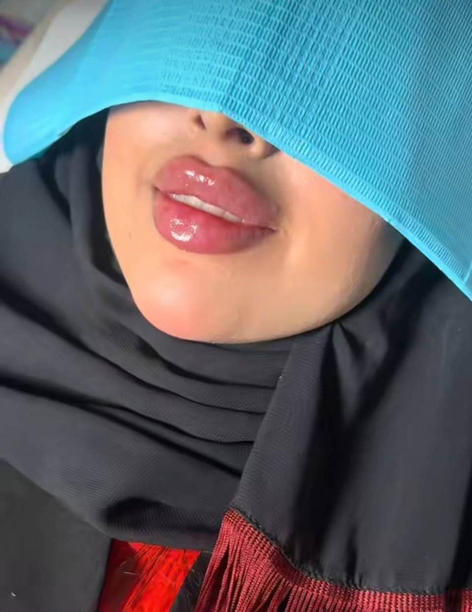عروض عيد الاضحى المبارك💫 السيسي الواحد 25 الف
للرجال والنساء 
العنوان مدينة الصدر الكياره قطاع٦٧ مقابل نادي الجولان مركز ايفا الطبي

‏‪***********‬‏ 📞
#اكبلور_العراق_السعوديه_الاردن_ايران_الكويت_طق_لايك_ات_كومنت_يلاا💜_فولو_بغداد_ميوزكلي_ #مدينة #مدينةالصدر #فلر_شفايف

