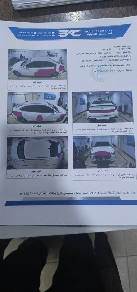 بيع سريع و سعر بلاش
سوناتا اصل 23
صبغ عام تغير لون 
سعر ب 115$ قفل 
حره 
ترقيم مجاني 
سونار مرفق

***********
