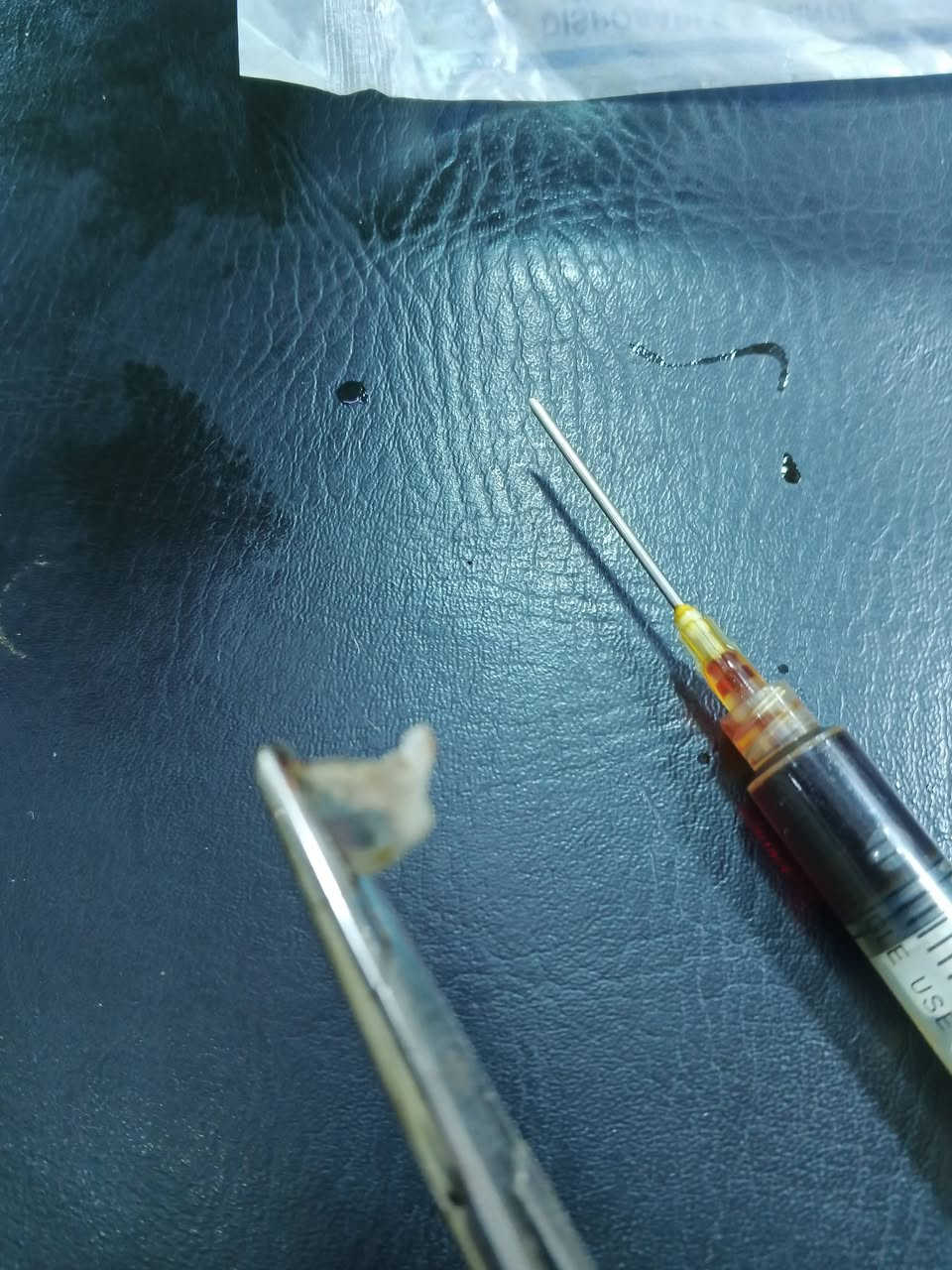 اليوم زارتنا الطفلة فاطمة من اهالي السيدية وعدها اظفرها ملتهب وتم قلعه تحت التخدير الموضعي والحمدلله على السلامه الممرض الفني أبو نور السيدية شارع المستوصف مقابل اسواق جدو الدوام صباحا و مساءا ***********
