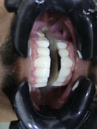 عيادة البدر • زراعة أسنان • تقويم أسنان