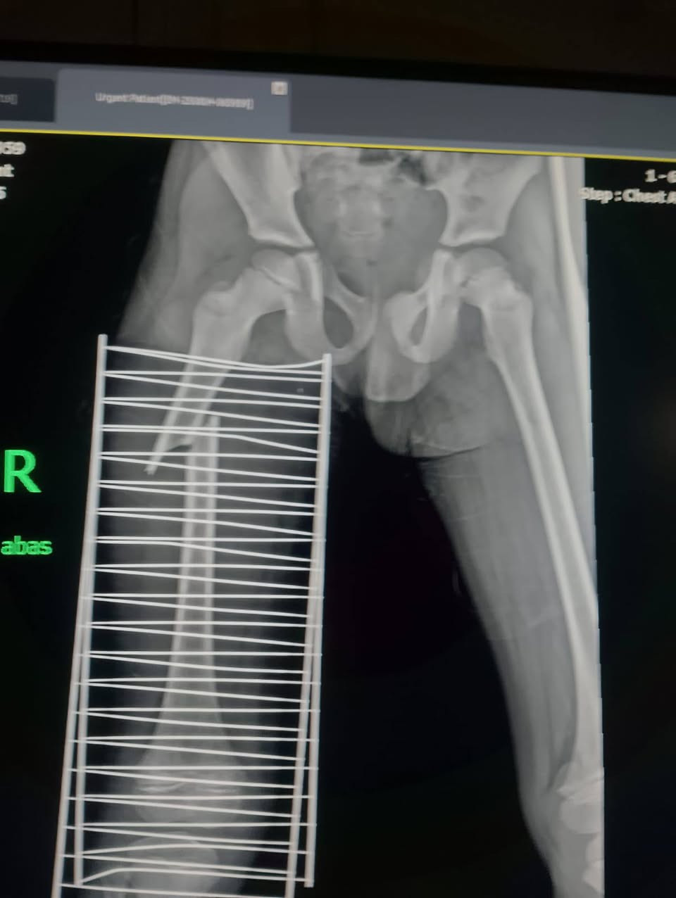 الحمدلله والشكر لله قمنا بخدمة محتاجين تم إجراء عملية من فاعل خير تبرع بل مبلغ خادمكم ميثم البياتي ***********يا الله ***********
