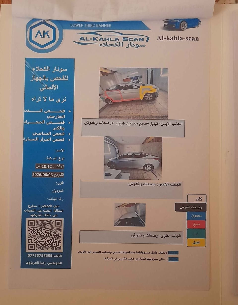 النترا موديل ١٢ افانتي محرك ١٦٠٠ gdi ماشي ١٨٥ الف كيلو مو ميل بأسمي رقم سليمانية الجديد شرط التحويل سونار موجود بيها جراد بدون ضربة قوية مكفول الشاصي والبدنة وارد كوري السعر ٨٦ ورقة وبيه مجال مكان بغداد الدورة هاتف بيه واتس اب *********** بغداد, العراق

