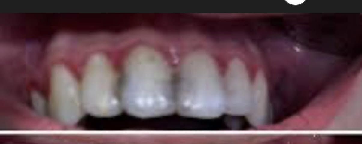 مرحبا
منو محتاج تنظيف اسنان او قلع او عنده تسوس هيج؟
يتواصل ويايه
جامعة المشرق شارع المطار مقابيل عباس ابن فرناس
***********واتس
