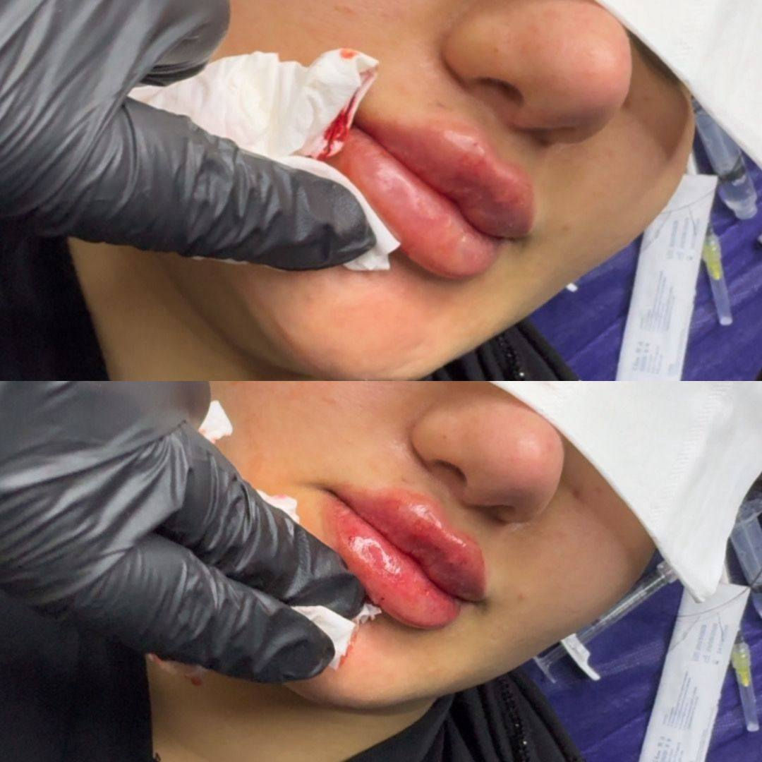 عروض عيد الحب 🫀❤️
حنين العزاوي – Haneen Alazzawy ✨
دقة، ذوق، ونتيجة تفتح النفس ❤️
📍 المكان: بغداد – الحسينية❤️
مقابل كراج الأسدي❤️
عيادة خبراء الطب التخصصي❤️
📞 رقم الهاتف: ***********
