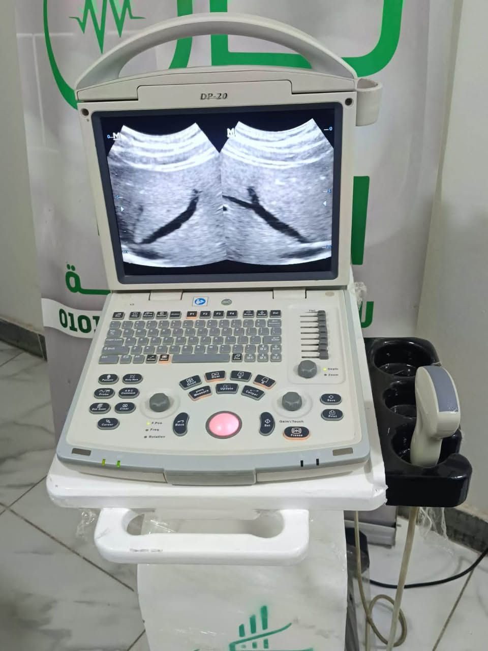 ✨ Mindray DP-20 ✨

جهاز سونار بحالة فوق الممتازة، جاهز للعمل بكفاءة عالية.

✔️ Black & White Ultrasound
✔️ Convex Probe
✔️ Single Probe Port (One Socket)

📞 للتواصل والاستفسار:
01226910709

#Mindray #DP20 #Ultrasound #MedicalEquipment #KayanMedical #UltrasoundMachine #MedicalDevices #أجهزة_سونار #أجهزة_طبية #Kayan_Medical


**إذا كنت صاحب هذا الإعلان وتريد حذفه لأي سبب، رجاءا أرسل رسالة إلى الدعم الفني**